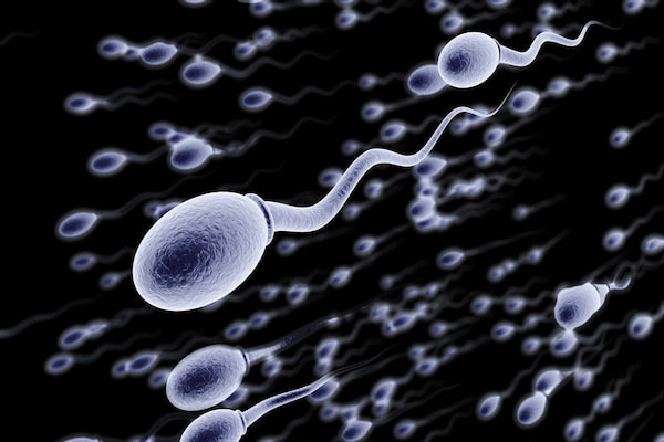 ناهنجاری های اسپرم چیست؟